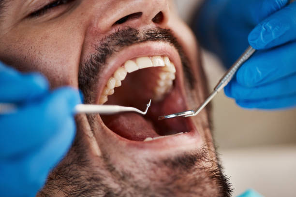 Best Emergency Treatment for Dental Infections or Abscesses in Mullica Hill, NJ